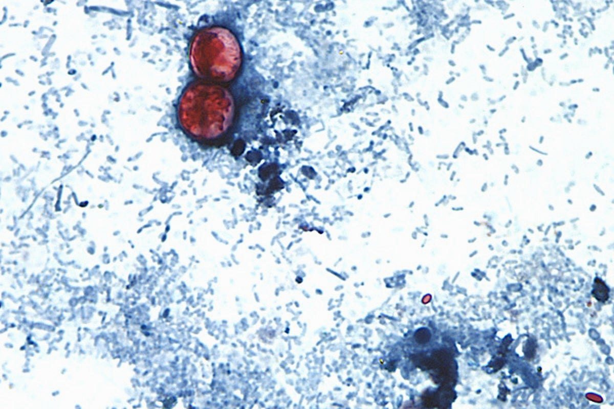 Officials warn holidaymakers as cyclospora outbreak spreads to UK