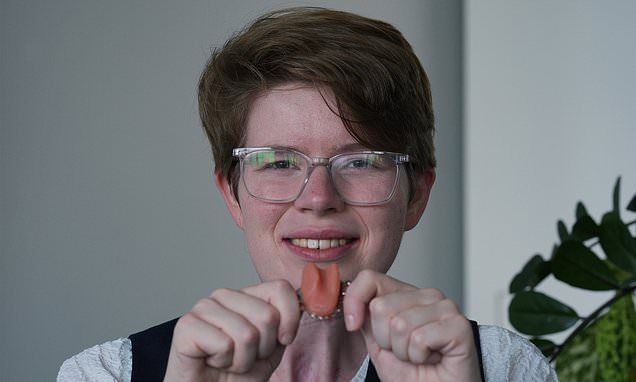 UK Doctor Receives First NHS Prosthetic Tongue After Cancer Surgery